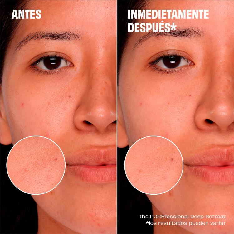HOLIDAY 2024 PORE CARE MINIS PEAS, LOVE & PORES (SET PARA CUIDADO DE LA PIEL)